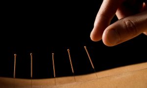 seminario-acupuntura-abdominal